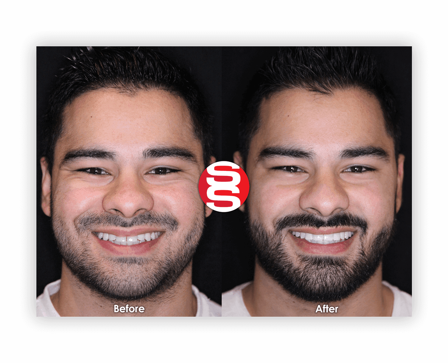 Man Smile Before After